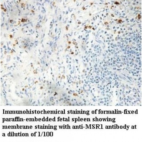 MSR1 Antibody