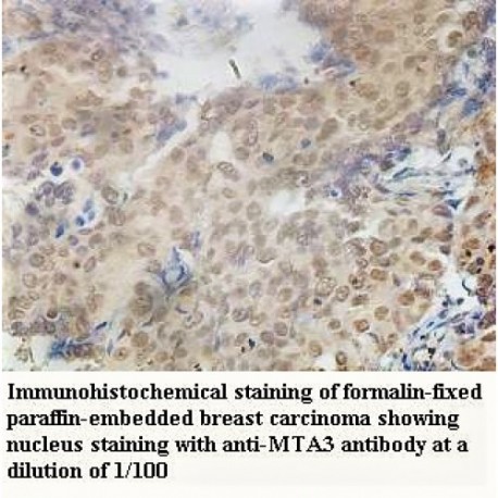 MTA3 Antibody