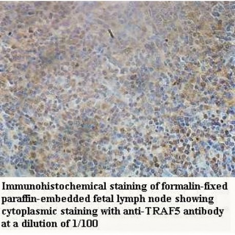 TRAF5 Antibody