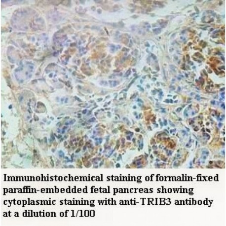 TRIB3 Antibody