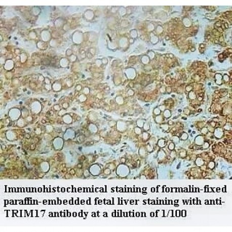 TRIM17 Antibody