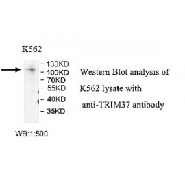 TRIM37 Antibody