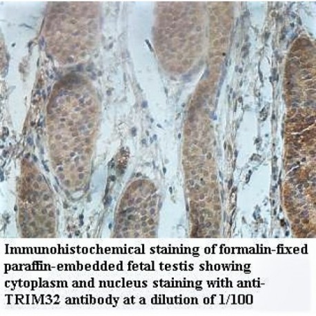 TRIM32 Antibody