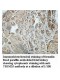 TRIM35 Antibody