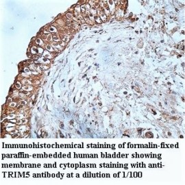TRIM5 Antibody