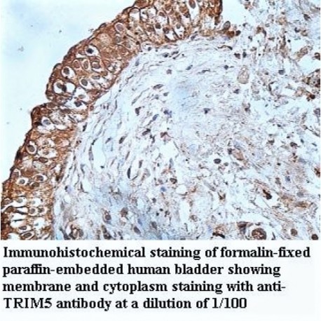 TRIM5 Antibody