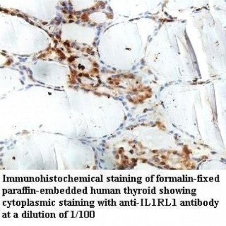 IL1RL1 Antibody