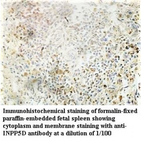 INPP5D Antibody