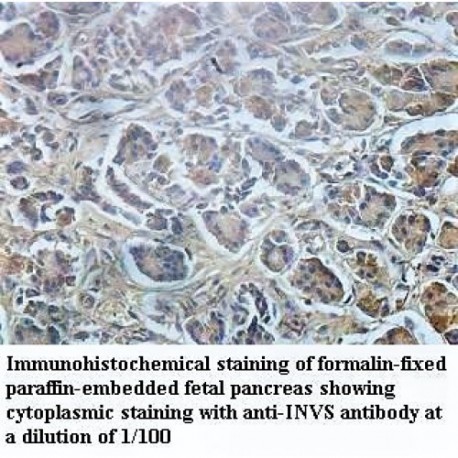 INVS Antibody