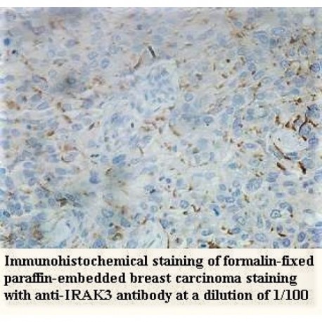 IRAK3 Antibody