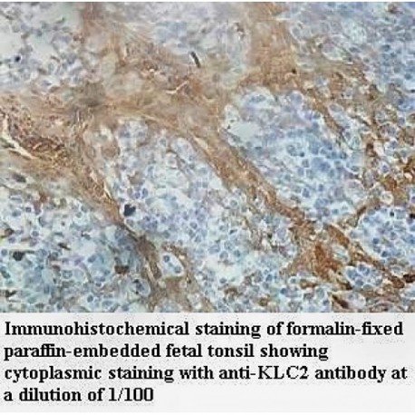 KLC2 Antibody