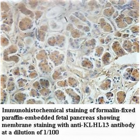 KLHL13 Antibody