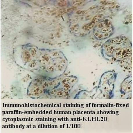 KLHL20 Antibody