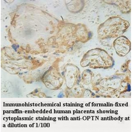 OPTN Antibody