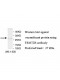 TRMT2B Antibody