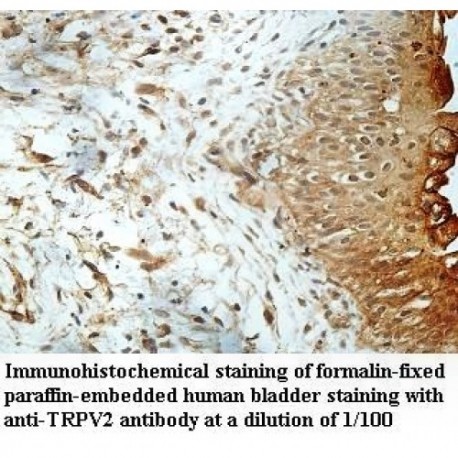 TRPV2 Antibody