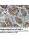 TSTA3 Antibody