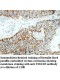 TSSK1B Antibody