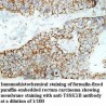 TSSK1B Antibody