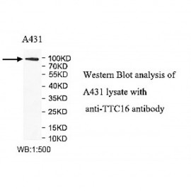 TTC16 Antibody