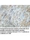 TTC17 Antibody