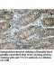 TTC23 Antibody