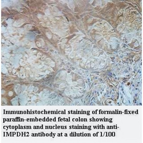 IMPDH2 Antibody