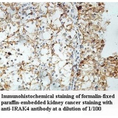 IRAK4 Antibody