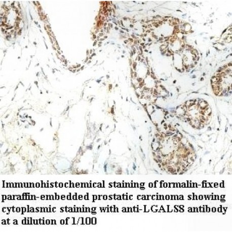 LGALS8 Antibody