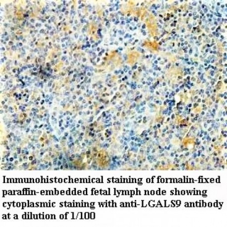 LGALS9 Antibody