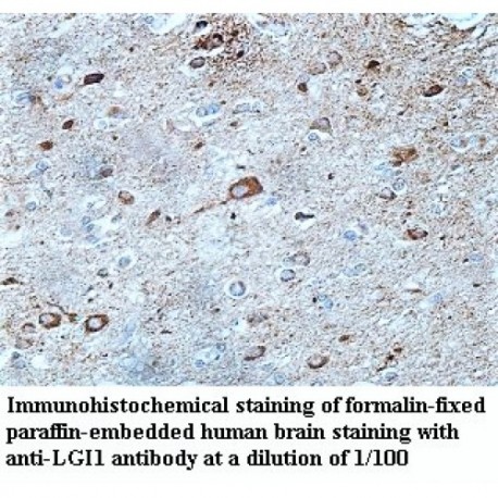 LGI1 Antibody