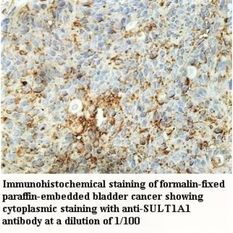 SULT1A1 Antibody