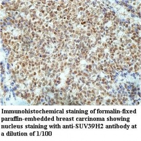 SUV39H2 Antibody