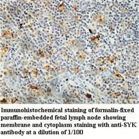 SYK Antibody