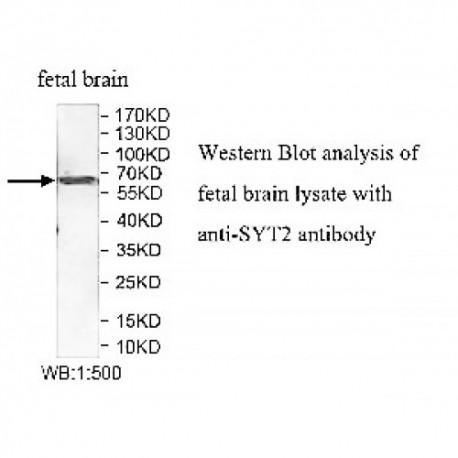 SYT2 Antibody