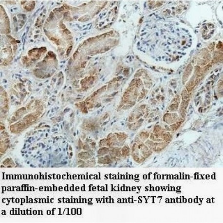 SYT7 Antibody