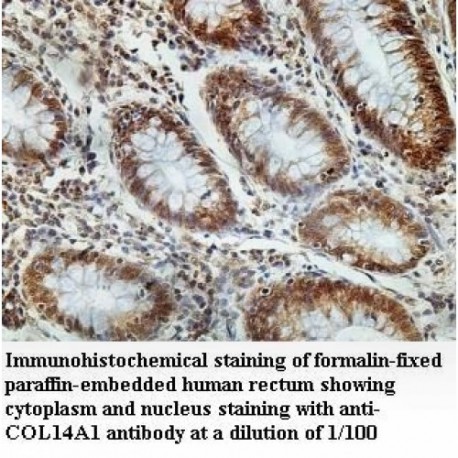 COL14A1 Antibody