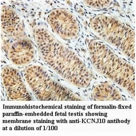 KCNJ10 Antibody