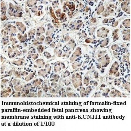 KCNJ11 Antibody