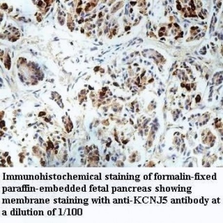 KCNJ5 Antibody