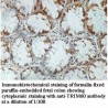 TRIM60 Antibody