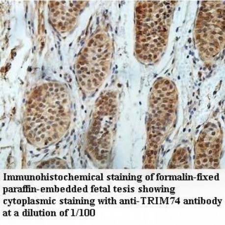 TRIM74 Antibody