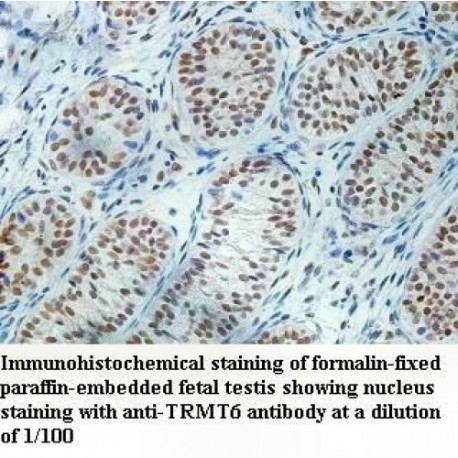 TRMT6 Antibody