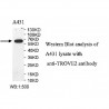 TROVE2 Antibody