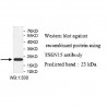 TSEN15 Antibody