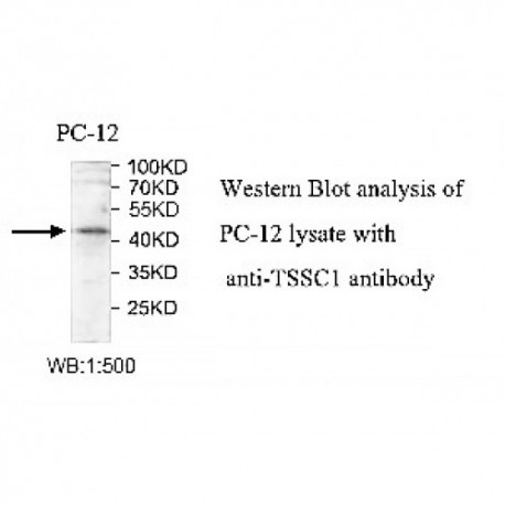 TSSC1 Antibody