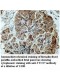 TTC27 Antibody