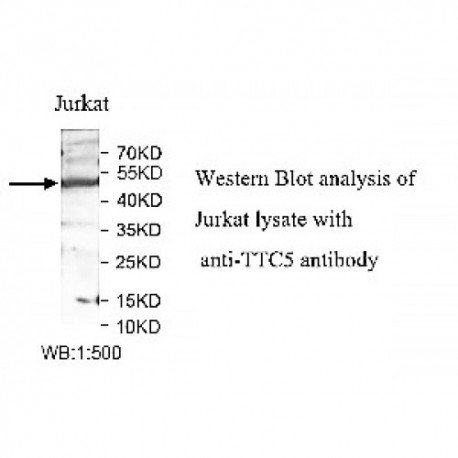 TTC5 Antibody