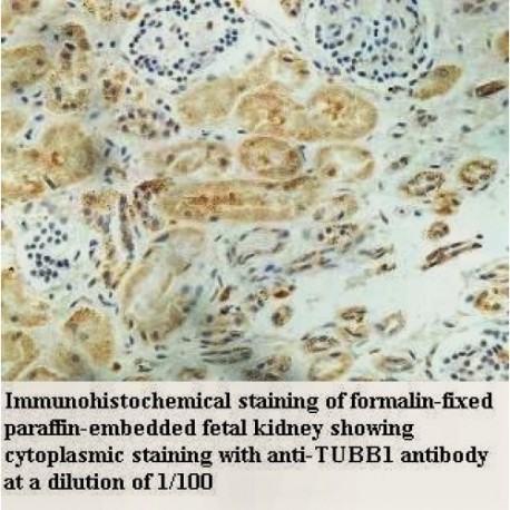 TUBB1 Antibody