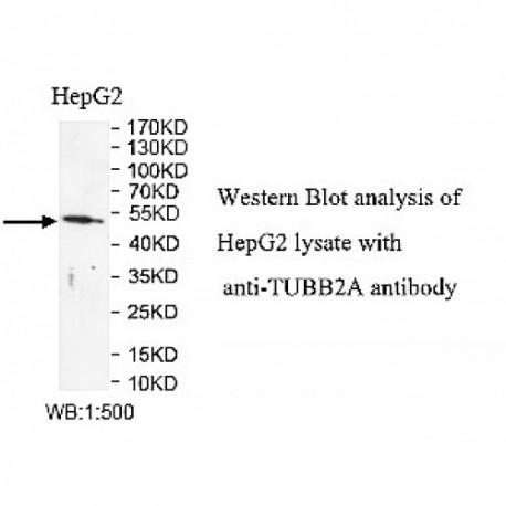 TUBB2A Antibody